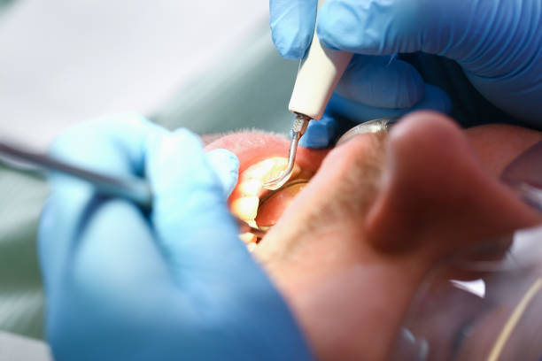 Best Same-Day Emergency Dental Services in Godley, TX
