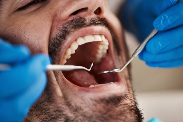 Best After-Hours Dental Trauma Care in Godley, TX